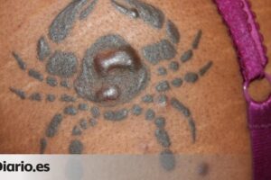 La relación entre el queso y la irritación de los tatuajes: mito o realidad